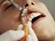 Oral Surgery West Covina